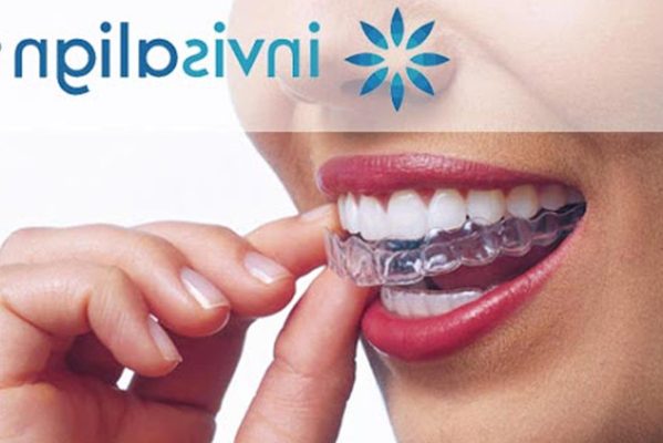 les-avantages-dun-traitement-orthodontique