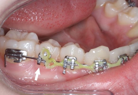 quest-ce-quun-orthodontiste